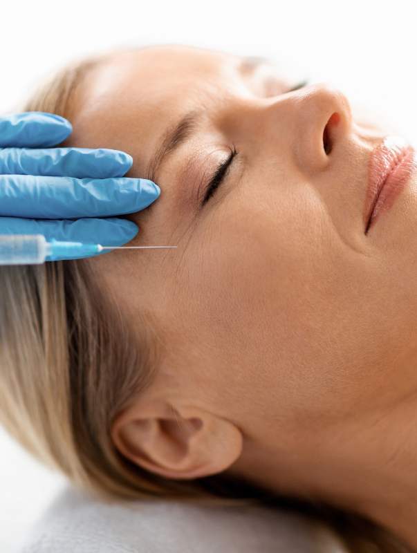 Hijeluronski filetr Hijeluronski filetr